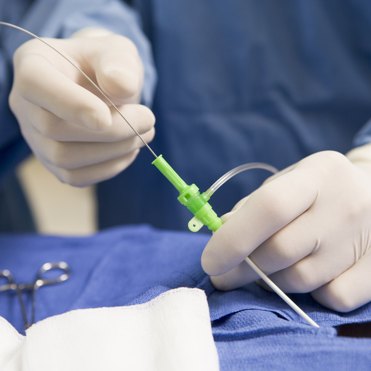 A cardiovascular procedure performed with plastic components by SPG