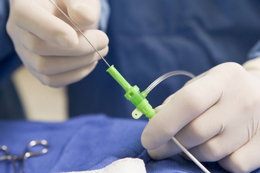 A cardiovascular procedure performed with plastic components by SPG