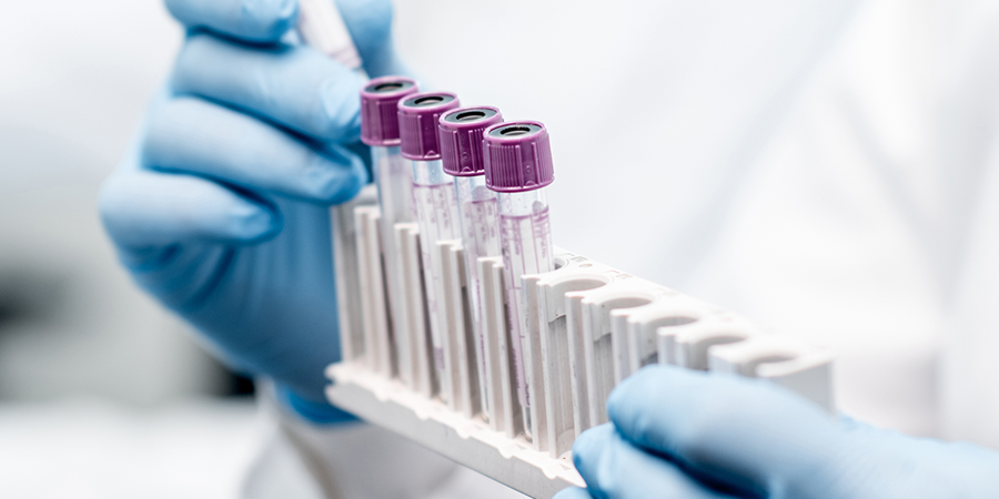 Extruded tubing, representing Spectrum Plastics Group's diagnostics solutions