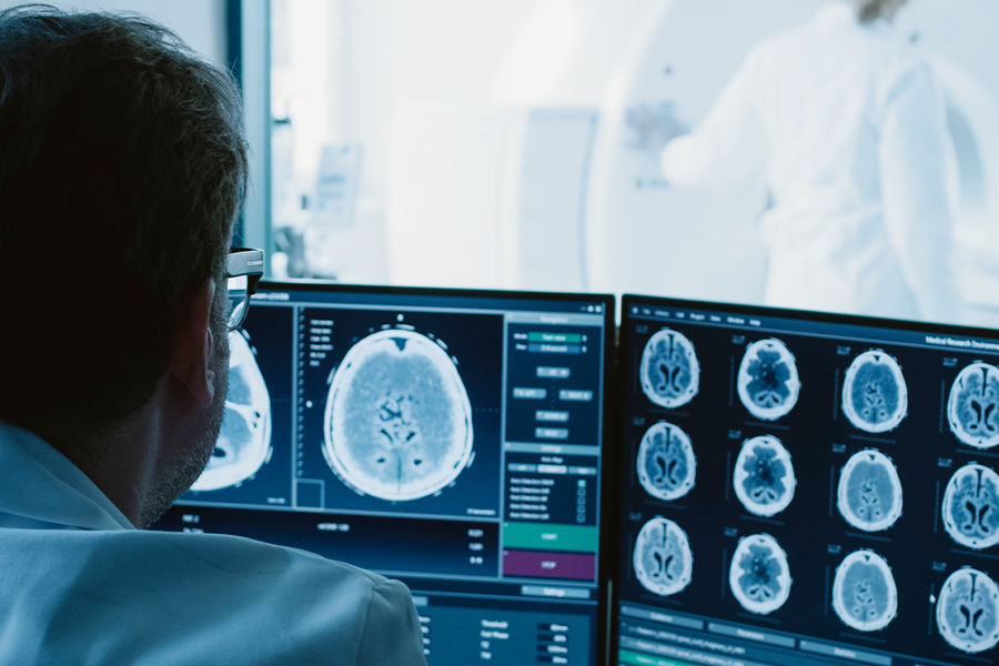 A neurovascular specialist reviews computerized scans of the human brain