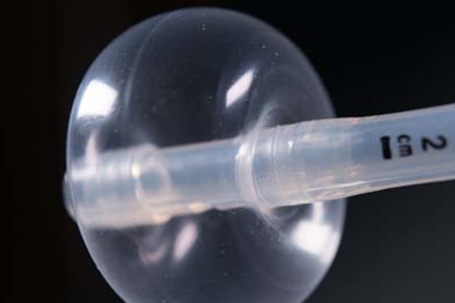 A silicone medical balloon formed by SPG's proprietary 